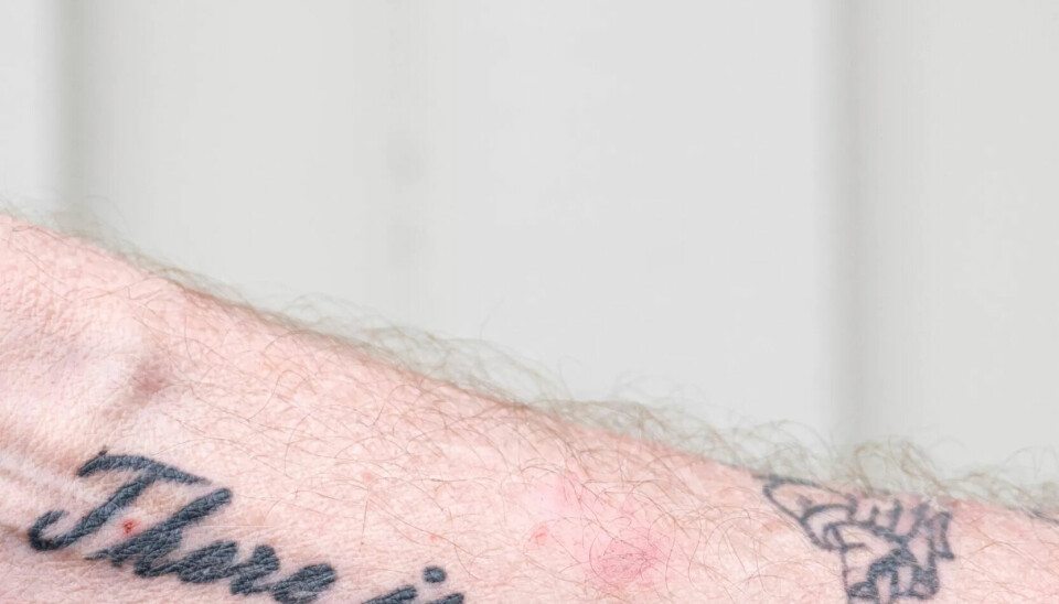Mads har LO-logoen tatovert på leggen