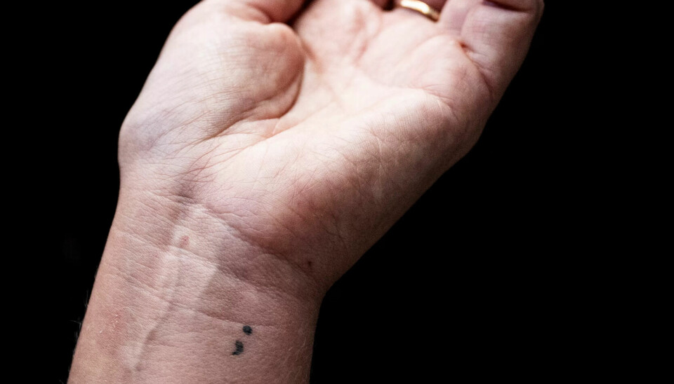Mads har LO-logoen tatovert på leggen
