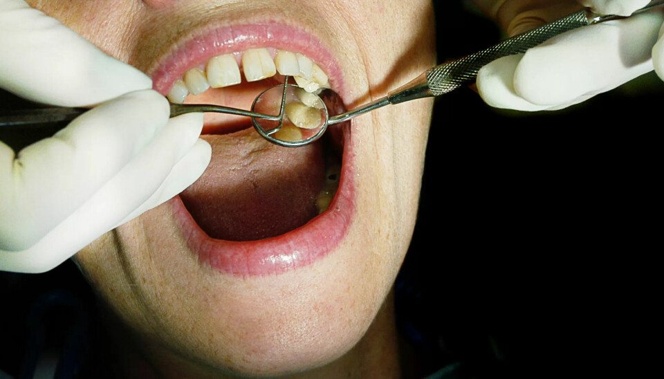 Regjeringen har totalt kuttet 380 millioner i tannhelse-støtte de siste fem årene, ved at satsene har stått stille og støtten har blitt kuttet til enkelte formål. Regjeringen har totalt kuttet 380 millioner i tannhelse-støtte de siste fem årene, ved at satsene har stått stille og støtten har blitt kuttet til enkelte formål.