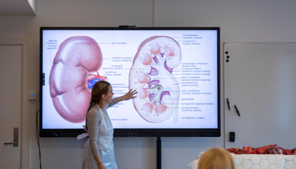 TEORI: Lærer Linda Rasmussen forklarer hva studentene har foran seg. Dette er nyra. TEORI: Lærer Linda Rasmussen forklarer hva studentene har foran seg. Dette er nyra.