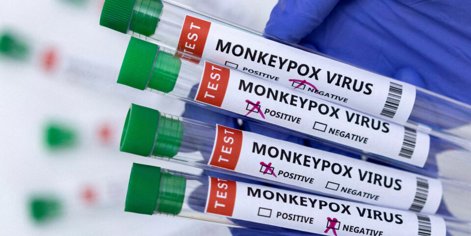 VIRUS: Utbruddet har rammet flere afrikanske land, spesielt Kongo. (Illlustrasjonsfoto) VIRUS: Utbruddet har rammet flere afrikanske land, spesielt Kongo. (Illlustrasjonsfoto)