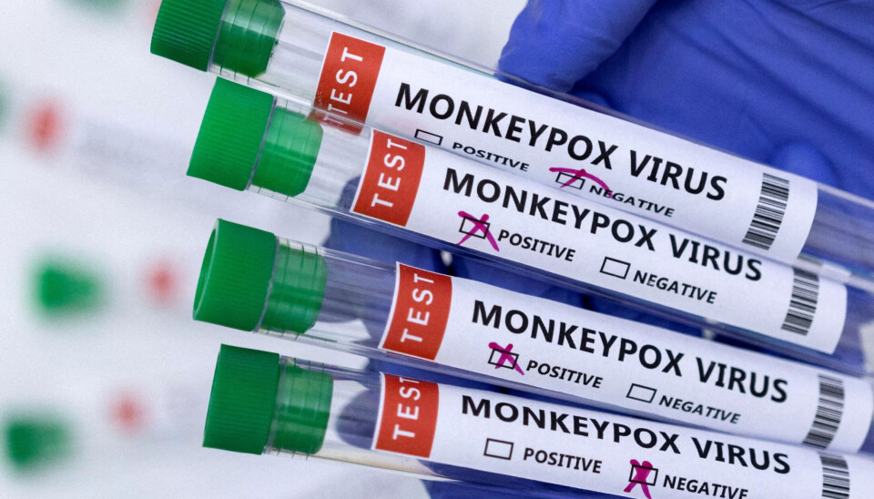 VIRUS: Utbruddet har rammet flere afrikanske land, spesielt Kongo. (Illlustrasjonsfoto) VIRUS: Utbruddet har rammet flere afrikanske land, spesielt Kongo. (Illlustrasjonsfoto)