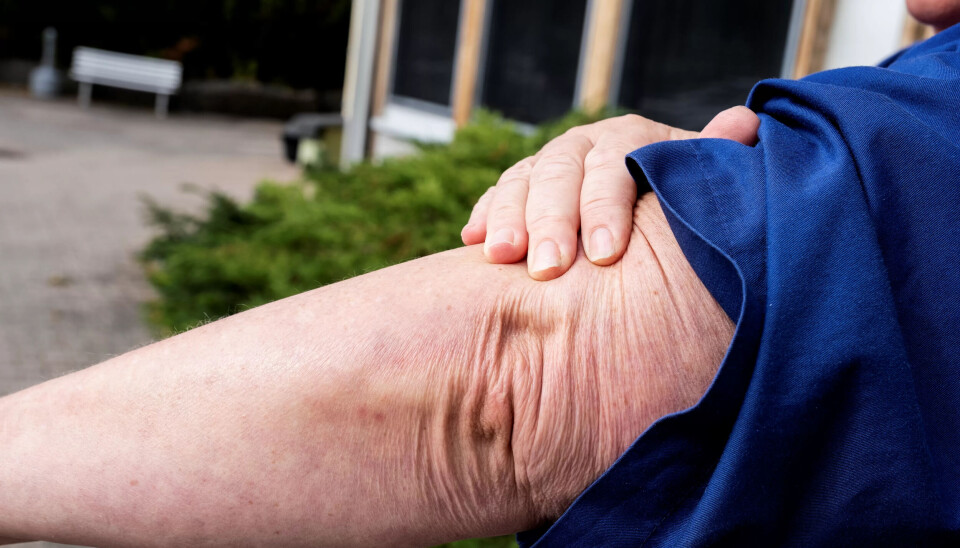 UTSATT: Det merkes på kroppen når du jobber med helse og omsorg. UTSATT: Det merkes på kroppen når du jobber med helse og omsorg.
