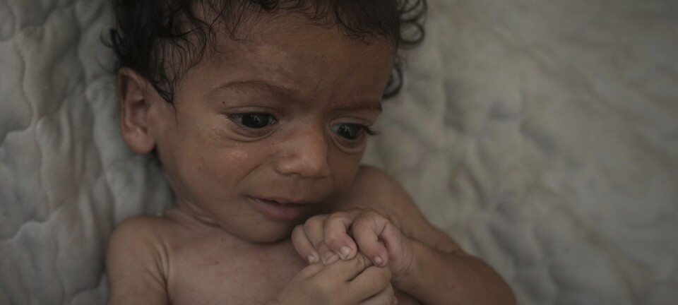 Amnesty: Israel driver bevisst utsulting i Gaza