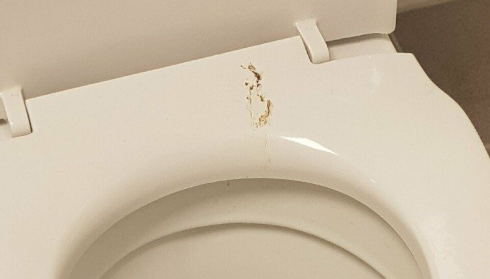 EKKELT: Det lukter som på en festivaldo, mener forelder Horgen.